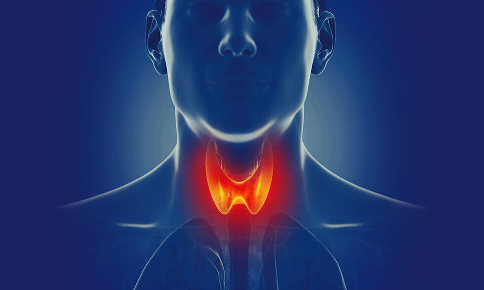 THYROID PROBLEMS