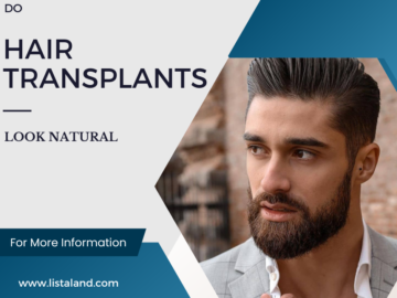 hair-transplantation