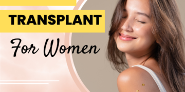 woman hair transplant