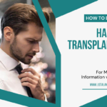 hair-transplantation