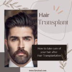 hair transplant