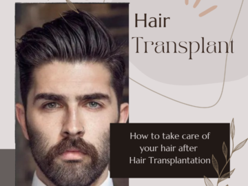 hair transplant