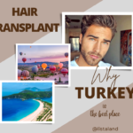 hair transplant turkey
