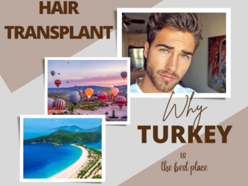 hair transplant turkey